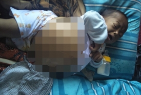 Bayi Alber-Kepahiang- Butuh Uluran Tangan